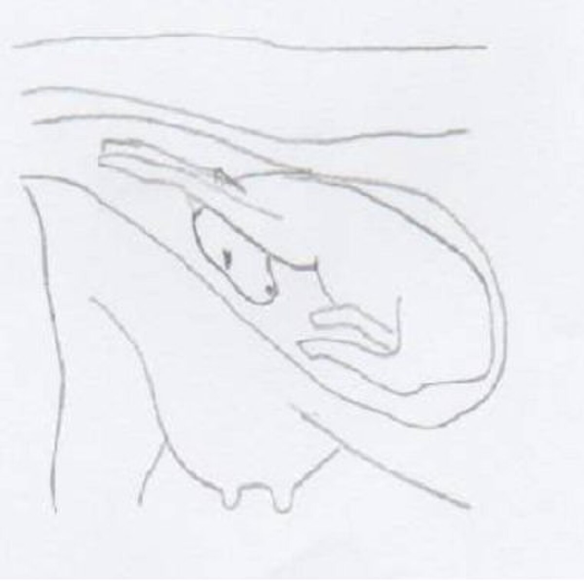 Dysposition3.jpg