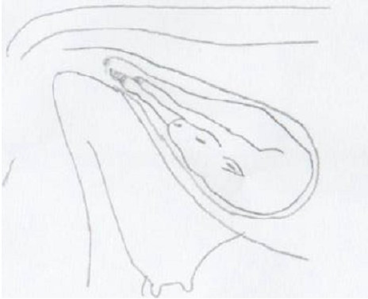 Dysposition8.jpg