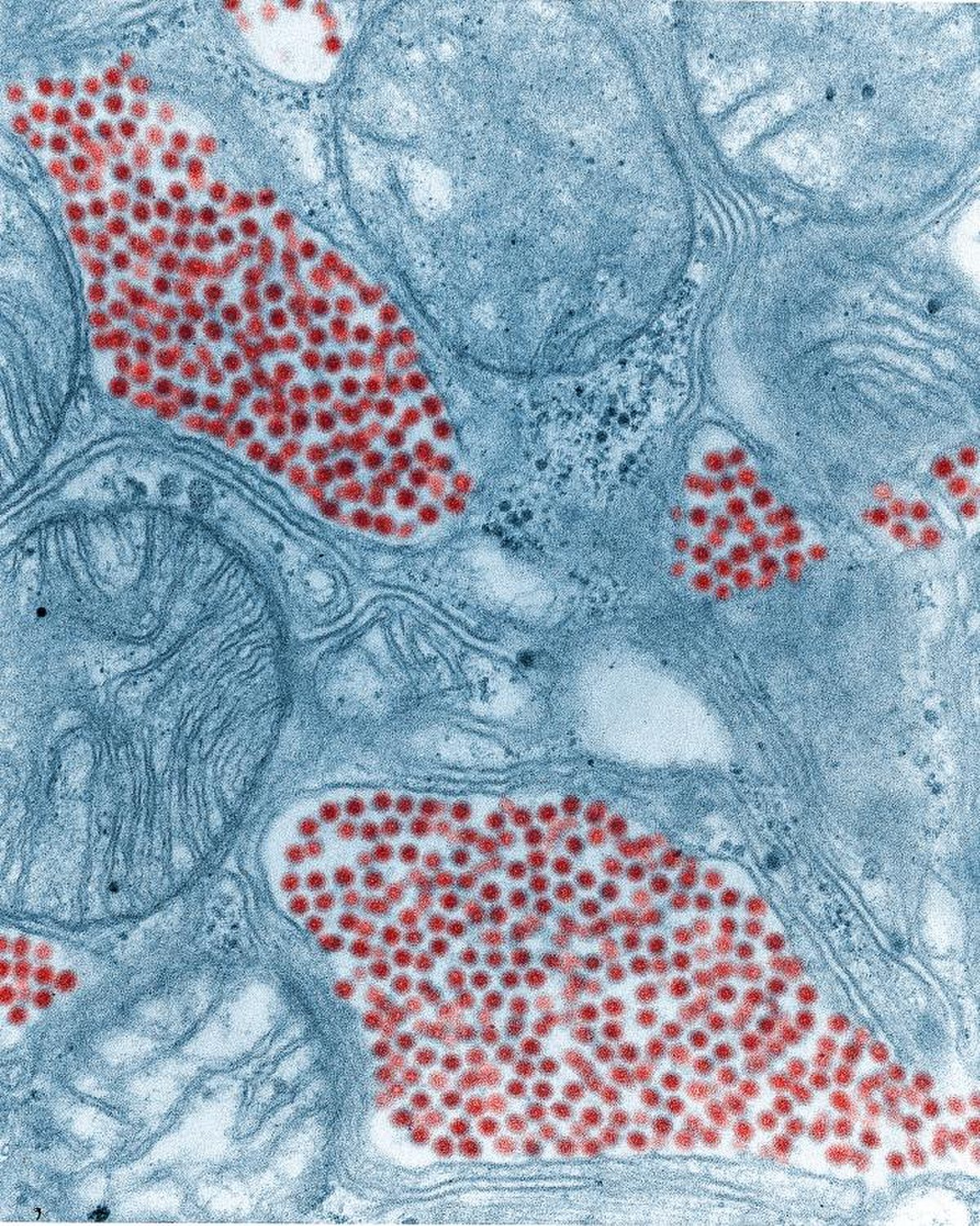 Virus de l’encéphalite équine de l’est, Microphotographie colorisée d’une Glande salivaire de moustique prise en Microscopie électronique en transmission. Les points remarquables sont colorés en rouge. (Grossissement x 83900)