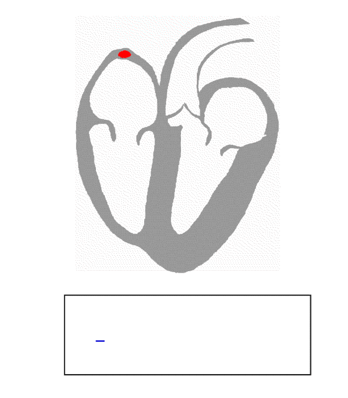 Cardiologie