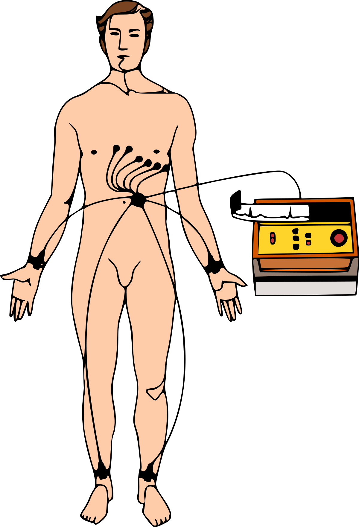 Électrocardiographie