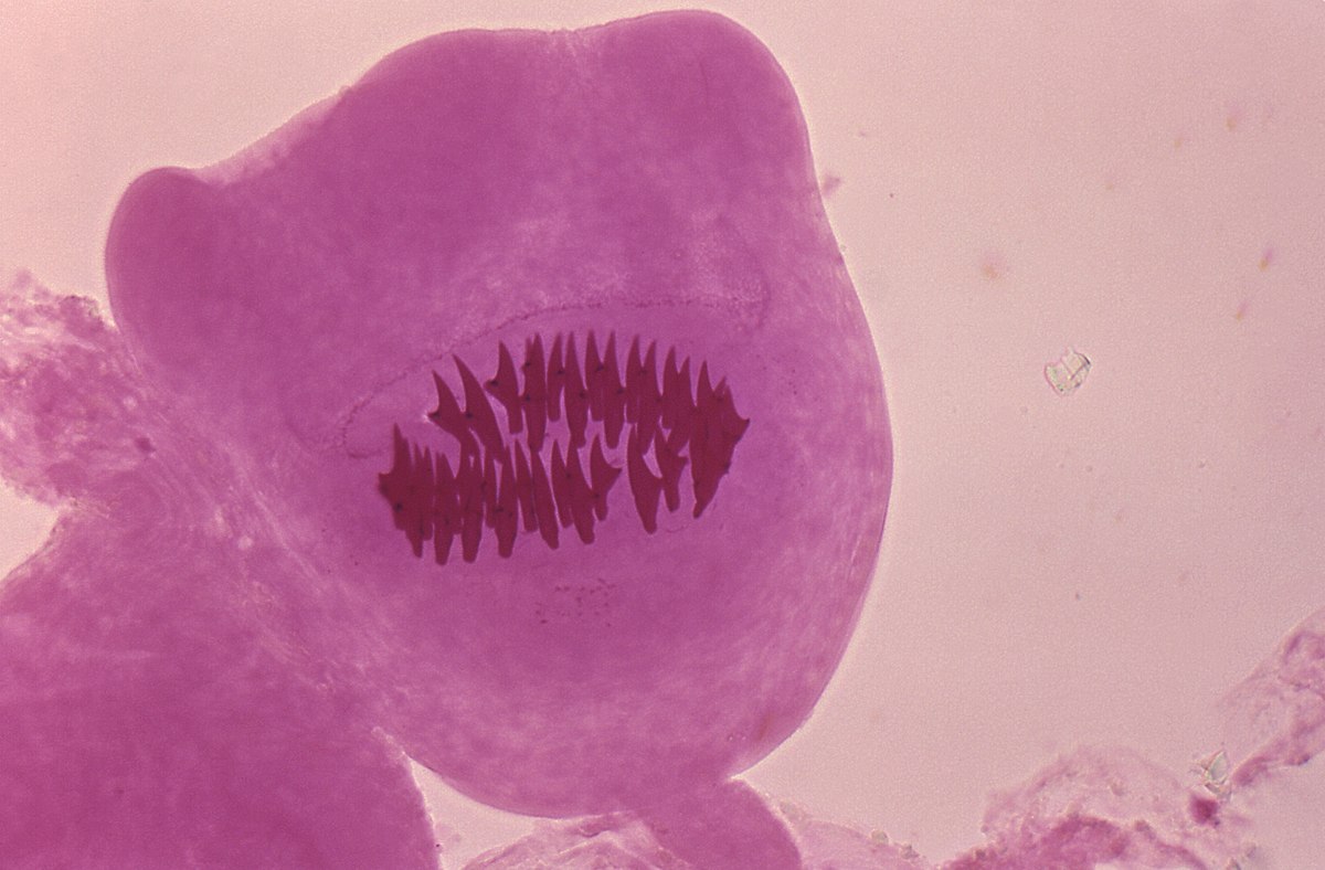 Echinococcus vogeli