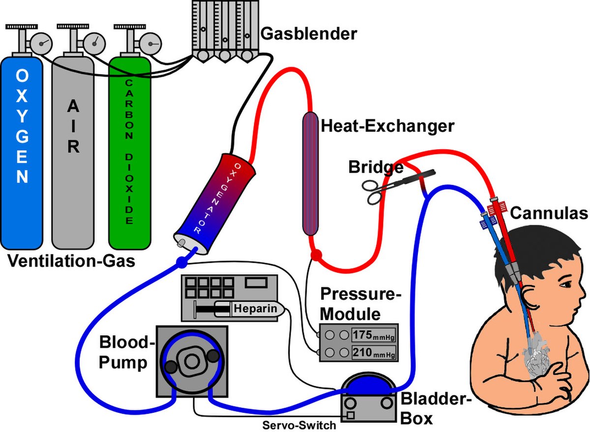 ECMO