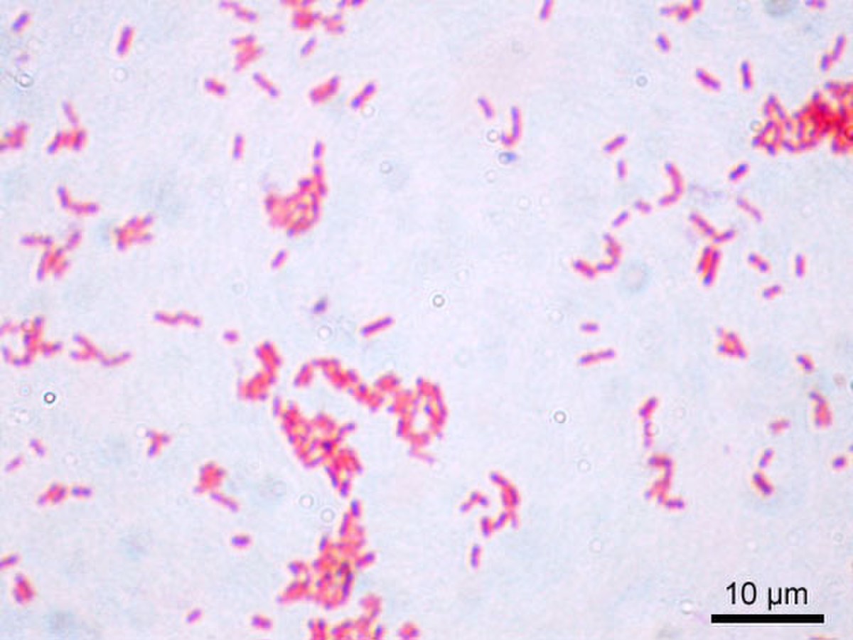 Des bactéries gram - (Escherichia coli)