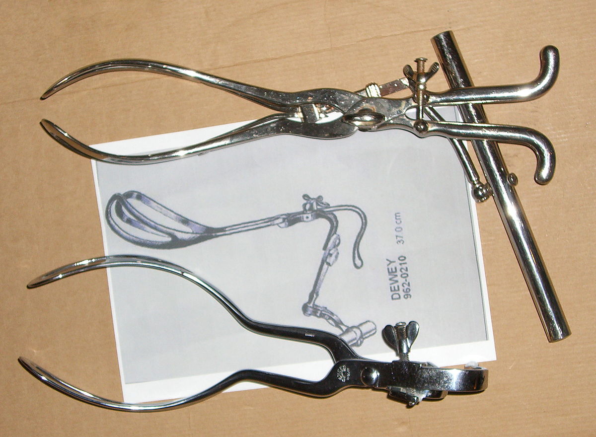 forceps à tracteur: Tarnier (1877) et Dewey (1900)