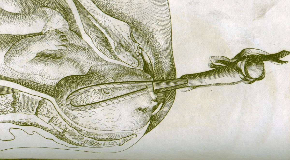 Forceps