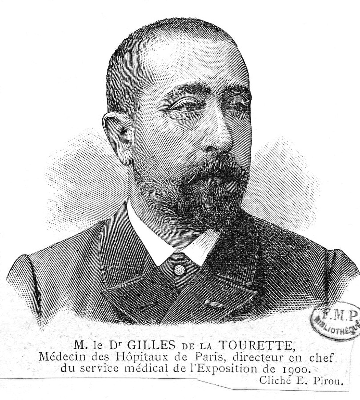 Maladie de Gilles de la Tourette