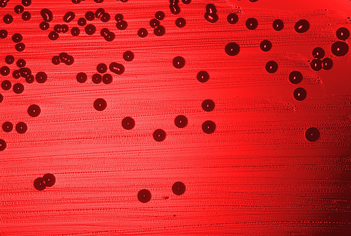 Haemophilus influenzae
