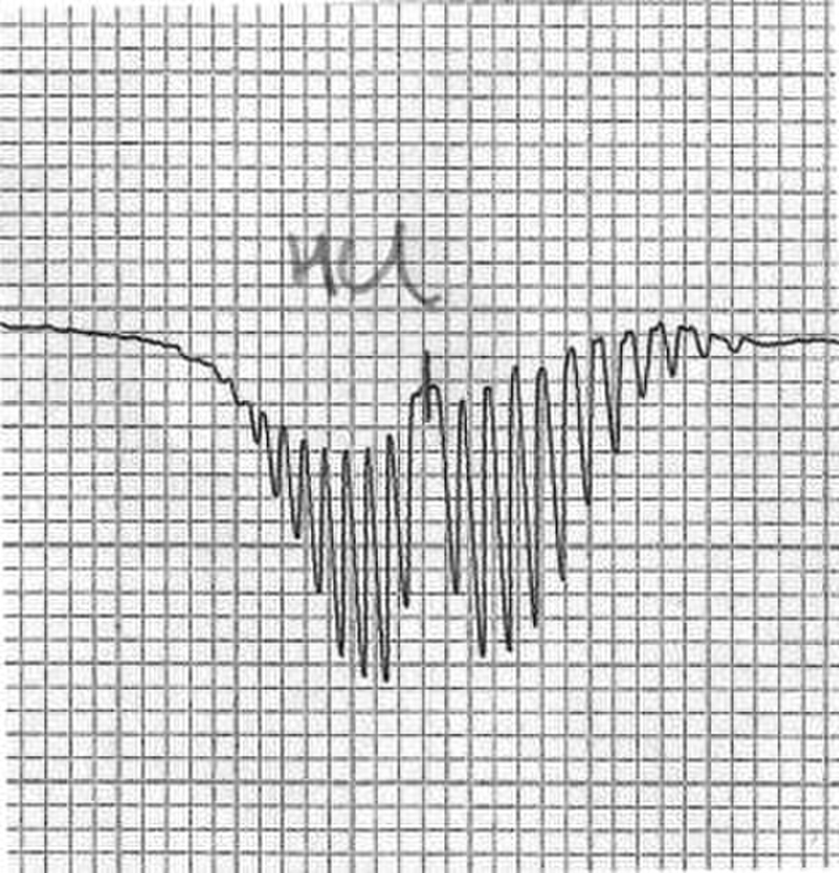 Spectroscopie rotationnelle