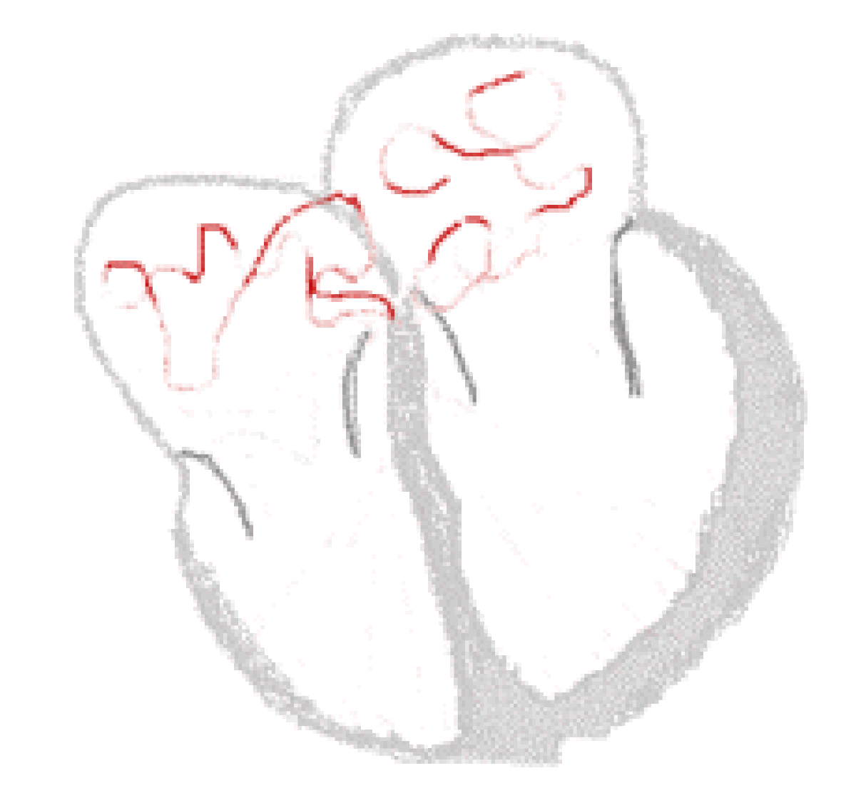 Heart conduct atrialfib.gif