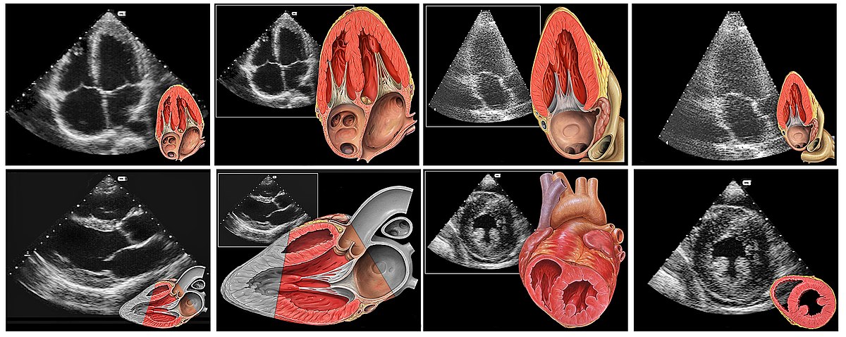 Heart normal tte views.jpg