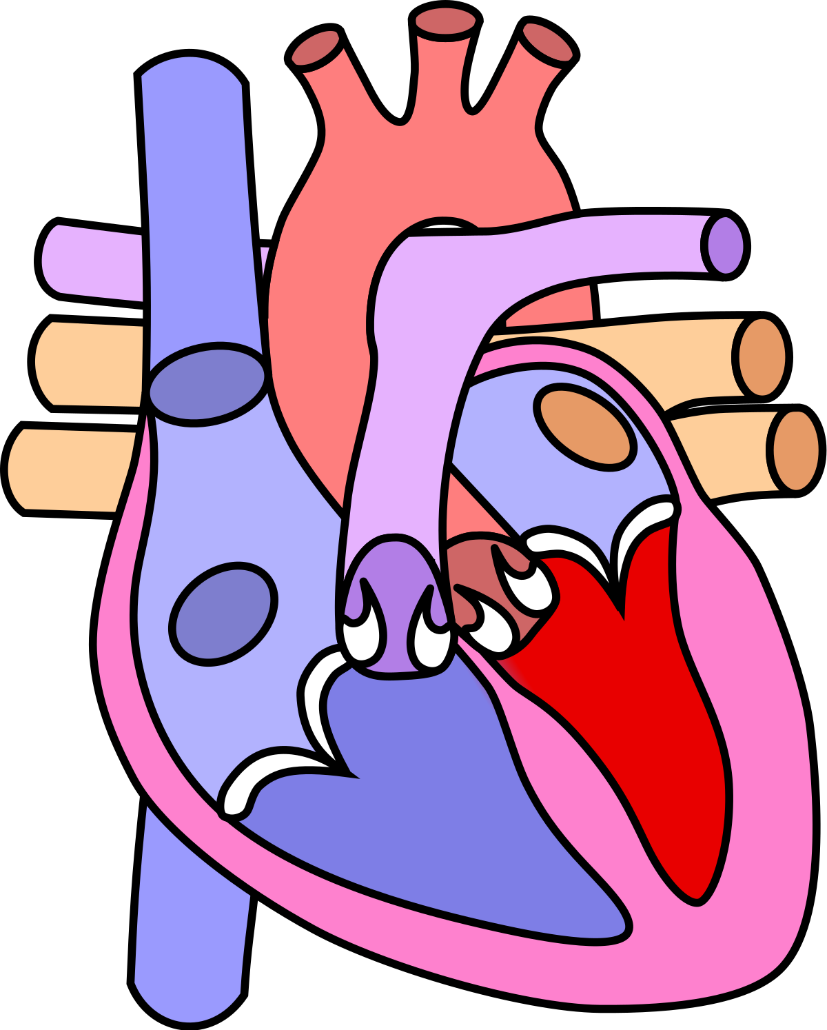 Cardiopathie congénitale