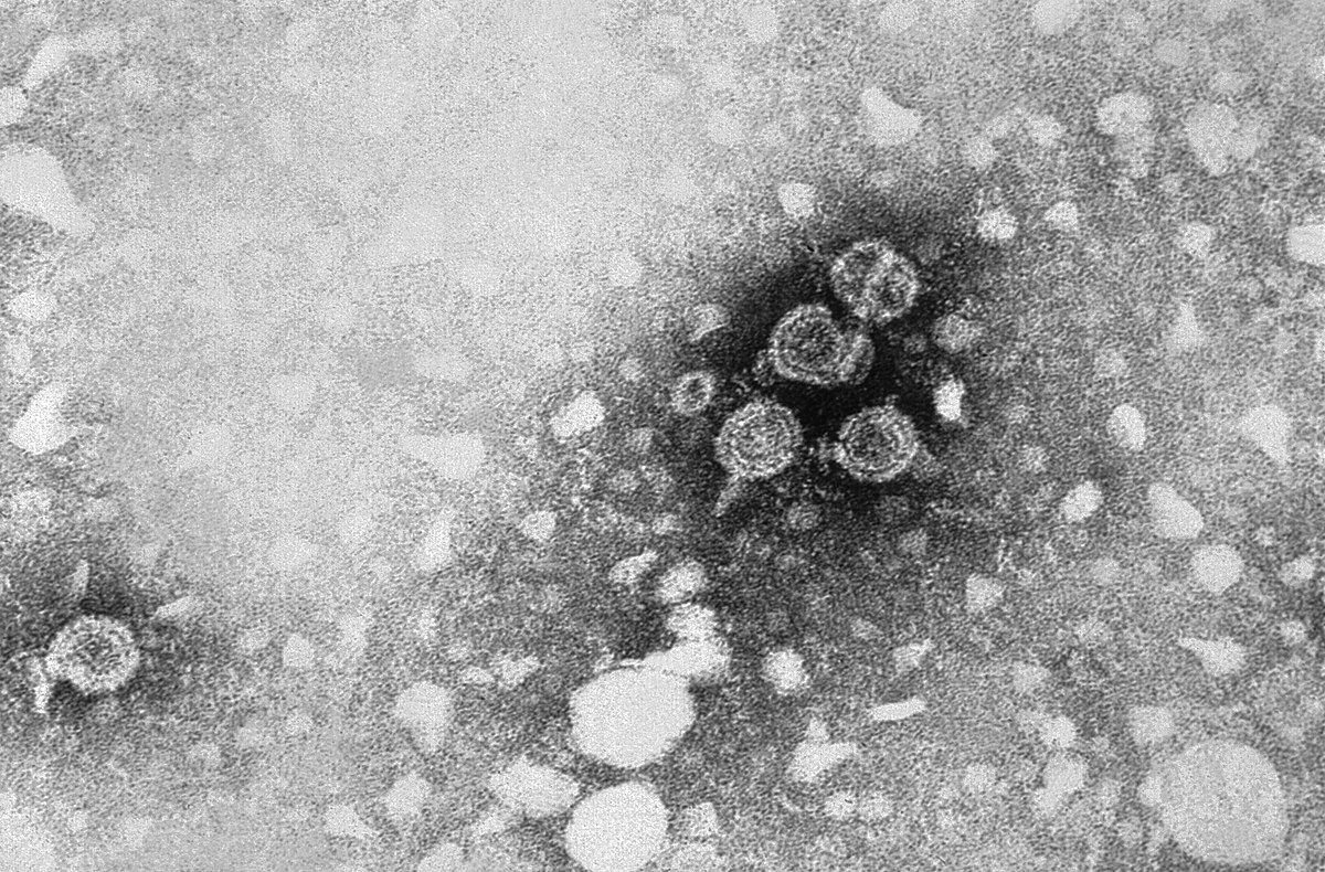 Virus de l'hépatite B
