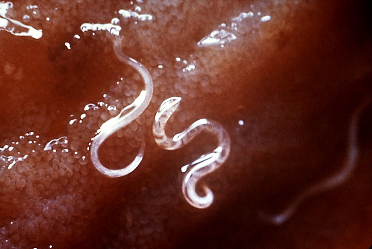 Ver parasite