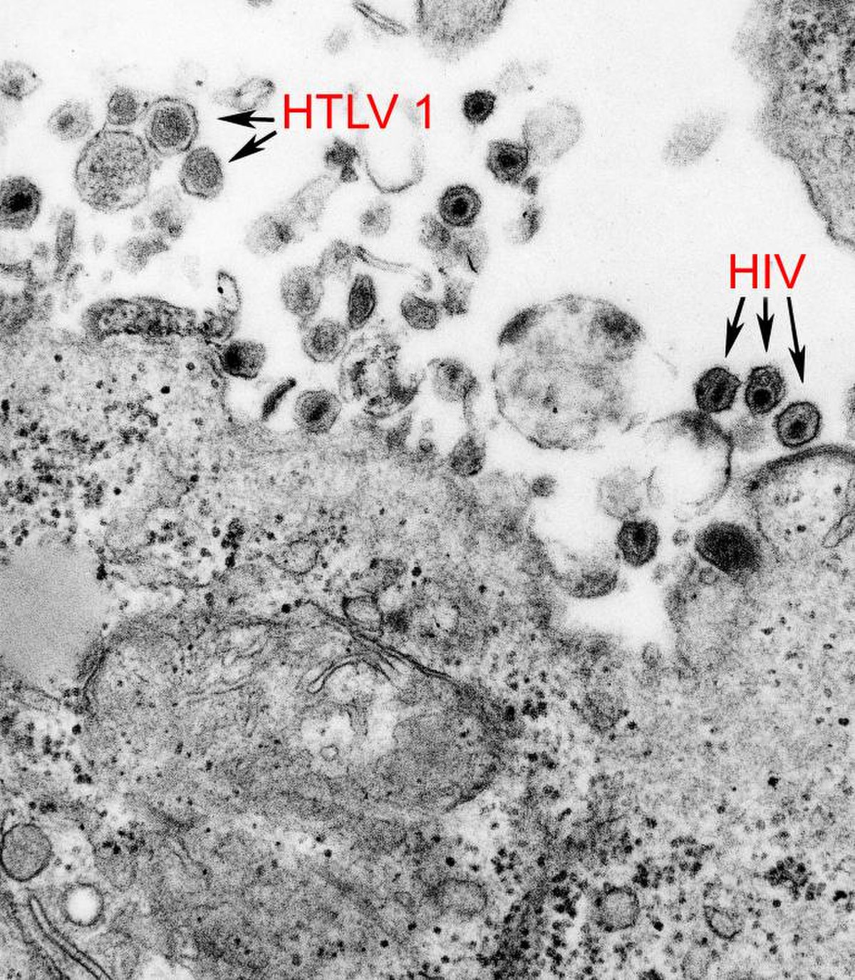 Virus T-lymphotropique humain