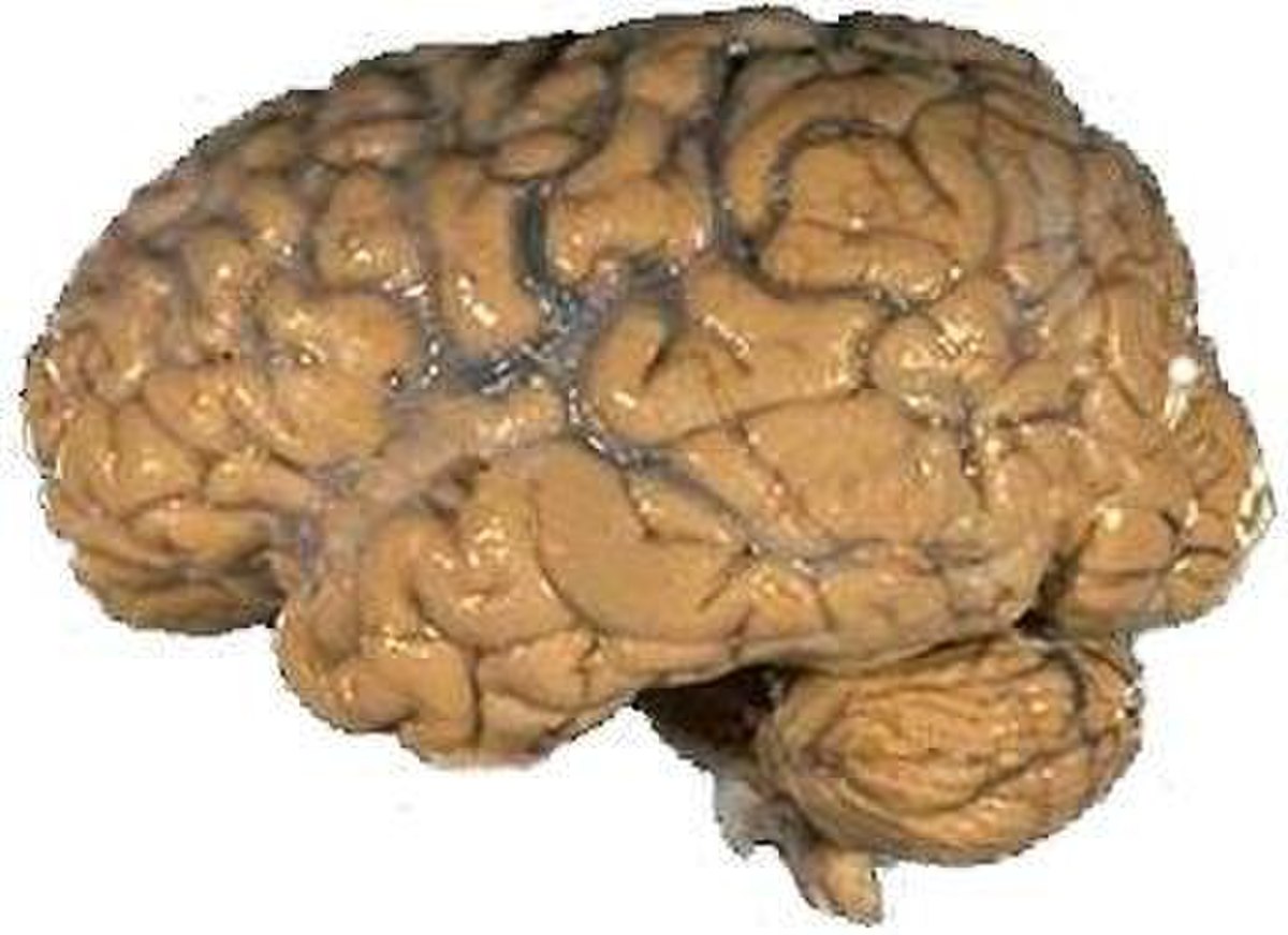 Neuropathologie