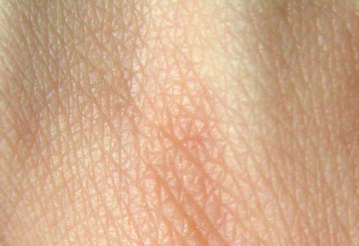 Peau