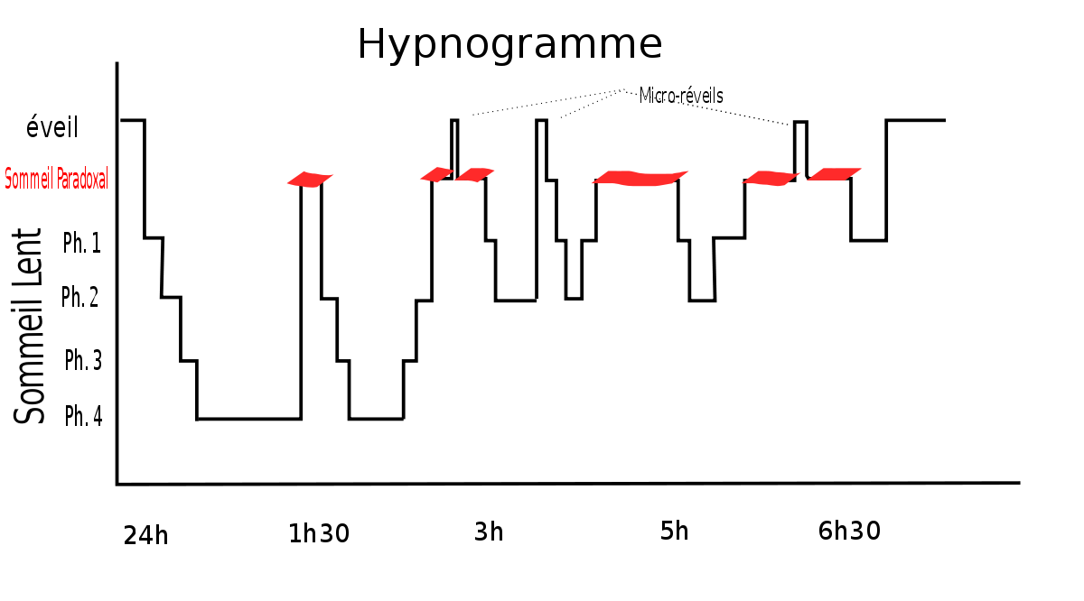 Hypnogramme.svg
