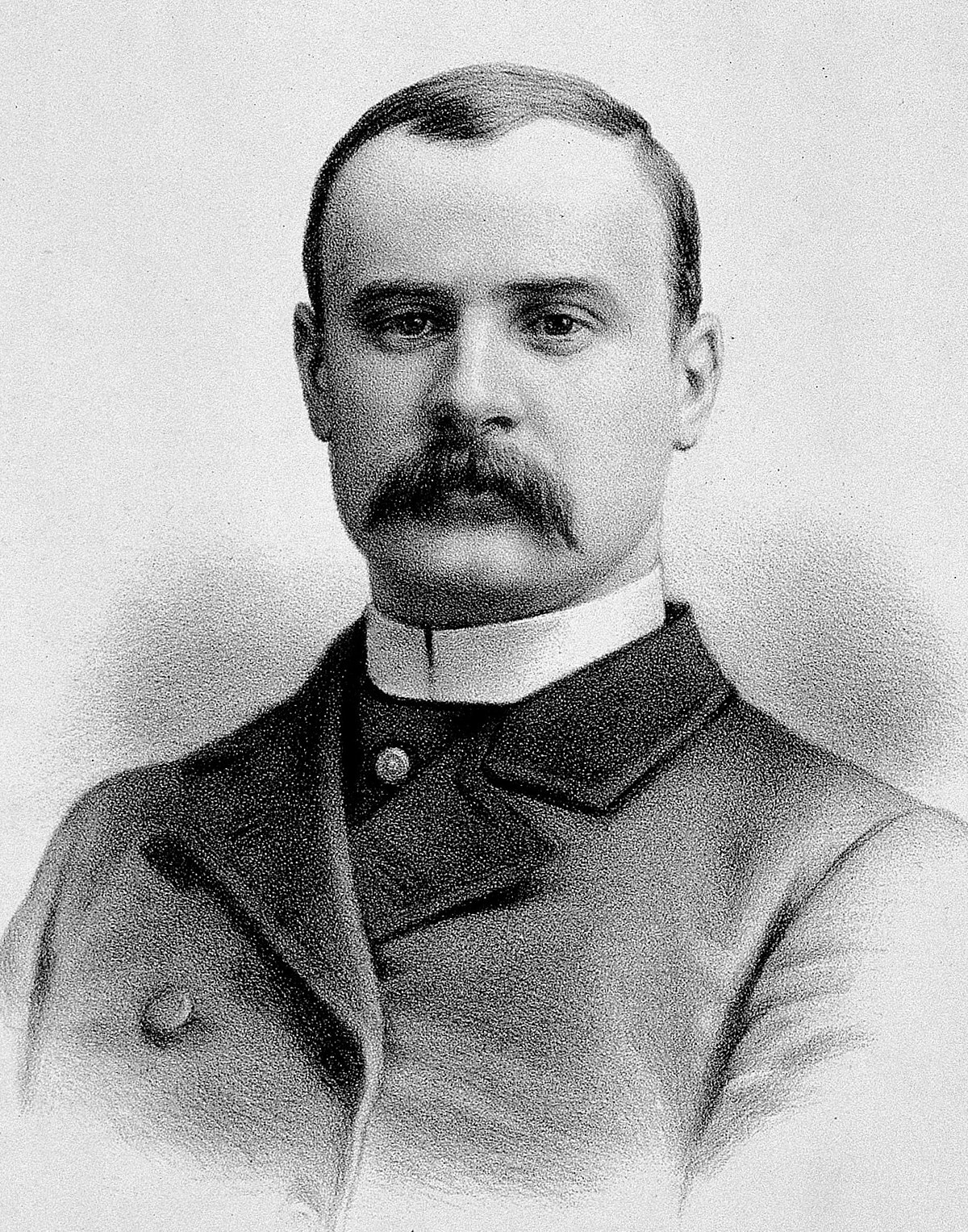 Joseph Merrick