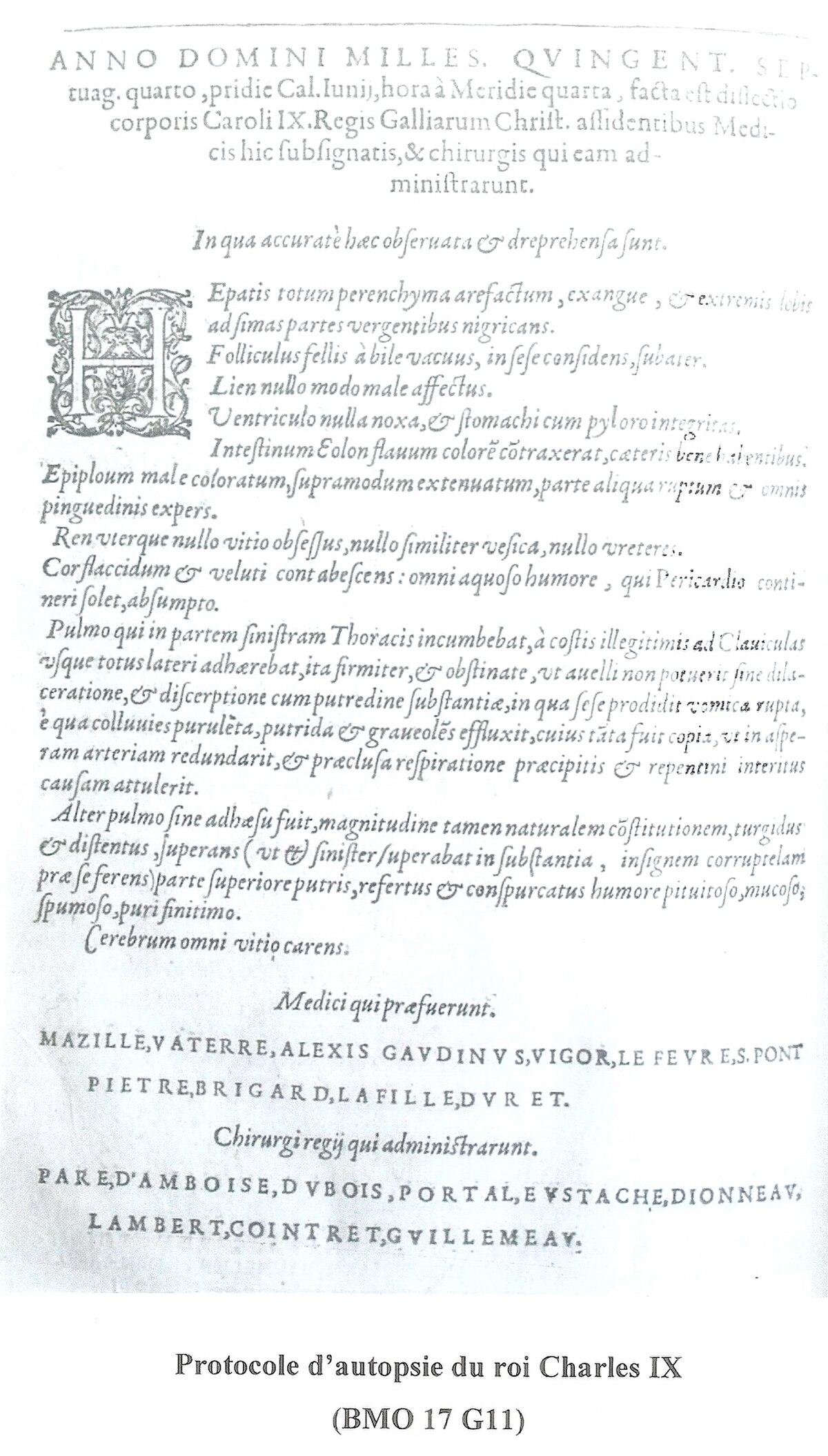 Protocole d'autopsie du roi Charles IX
