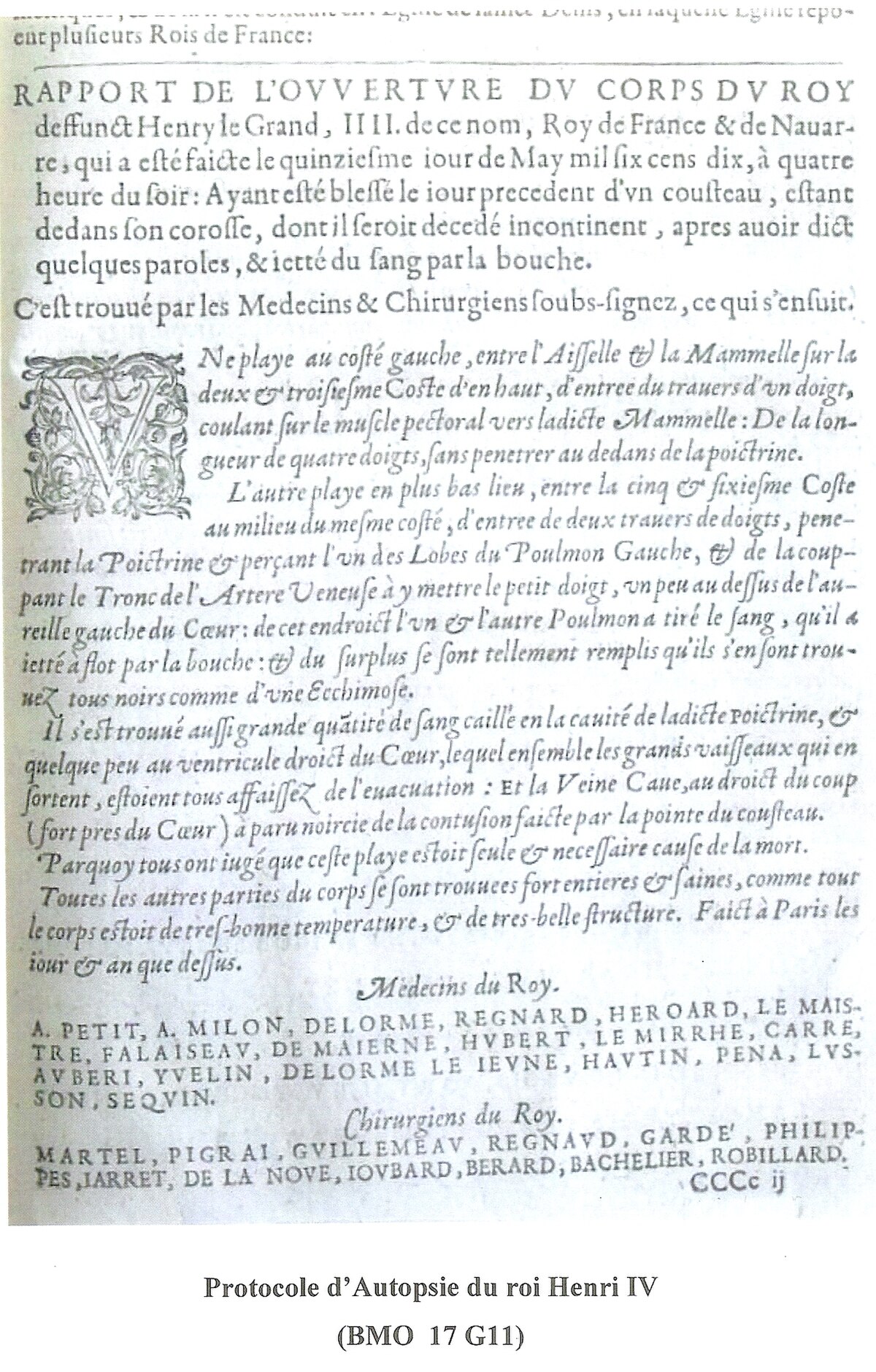 Protocole d'autopsie du roi Henri IV