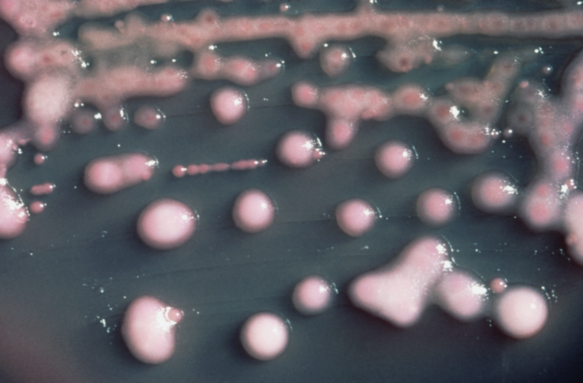 Klebsiella