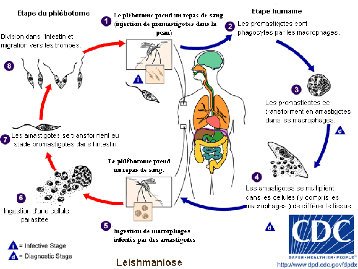 Leishmaniose viscérale
