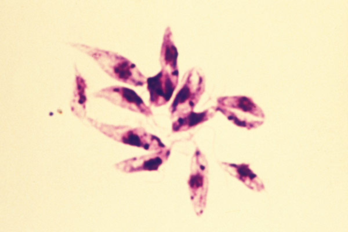 Leishmaniose