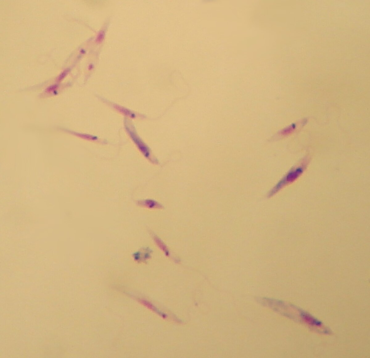 Leishmania tropica