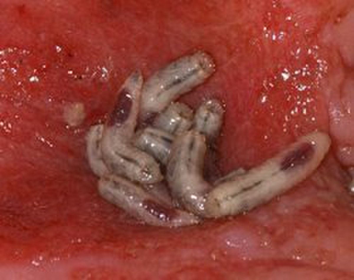 Asticothérapie