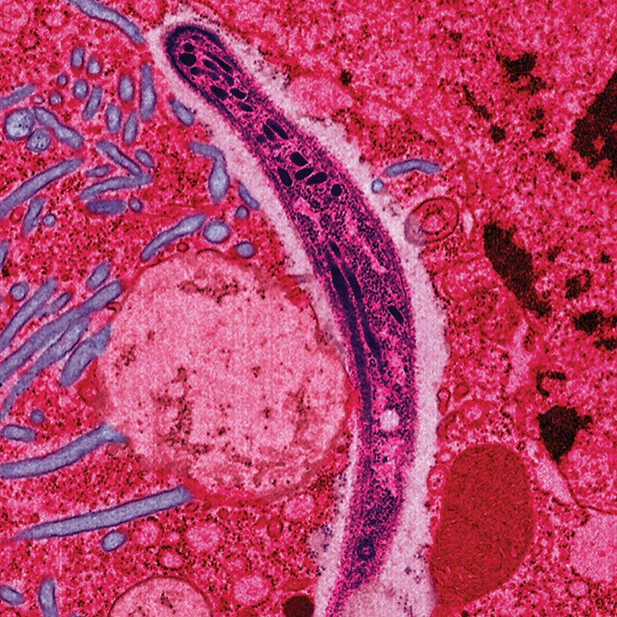 Plasmodium Falciparum. Crédit Université J. Hopkins.