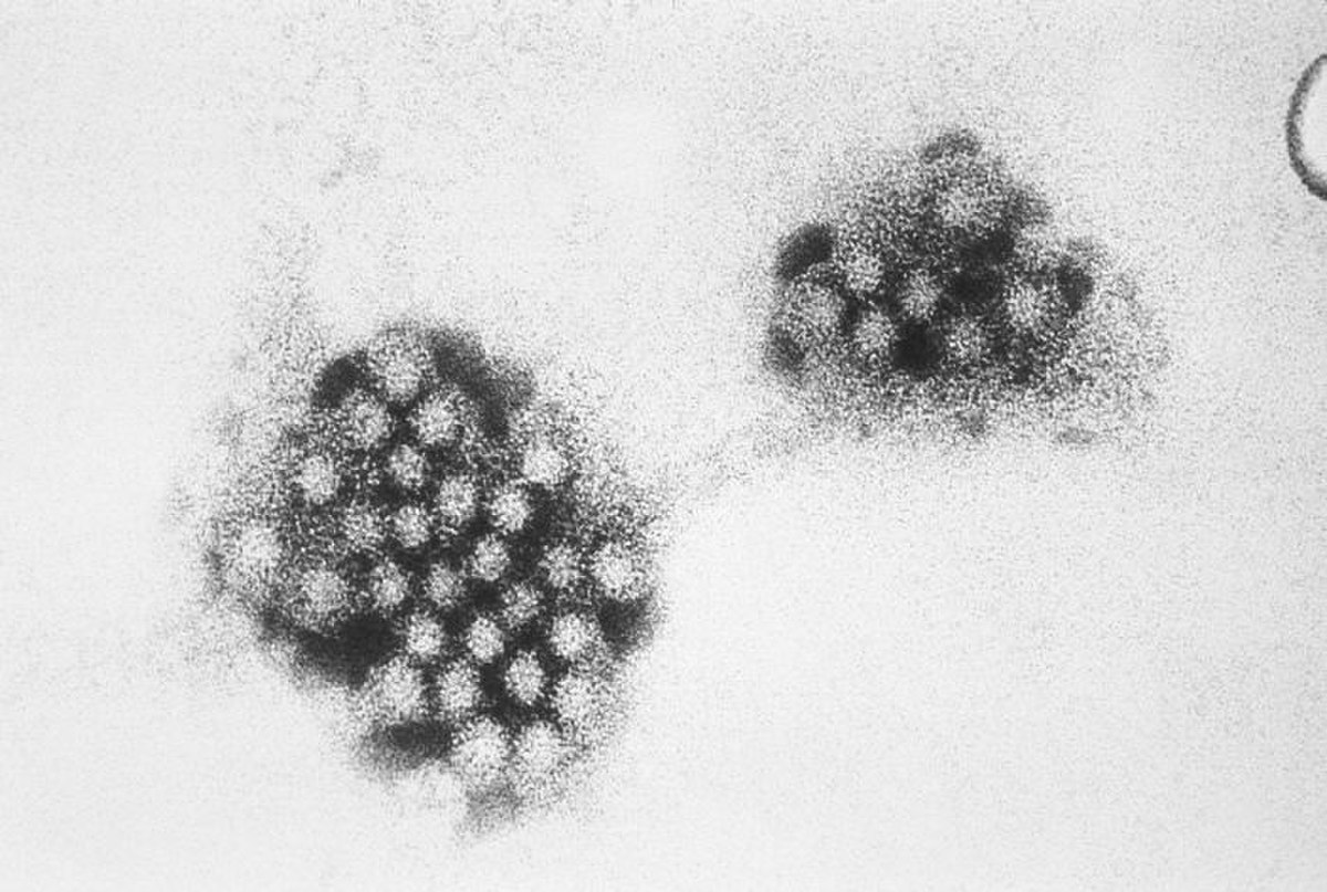 Virus de Norwalk