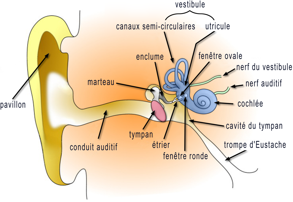 Surdité par traumatisme sonore