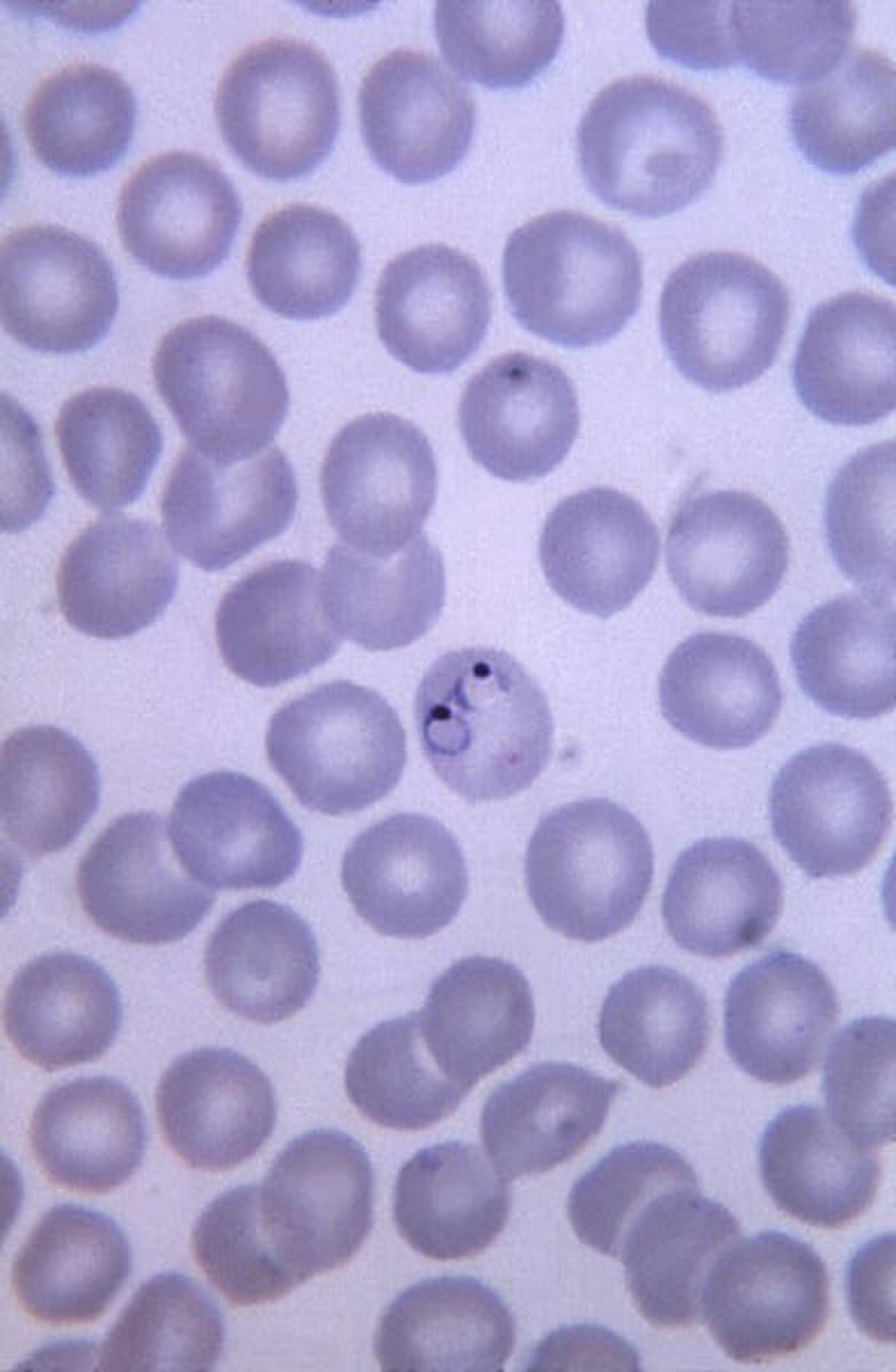anneaux de Plasmodium vivax