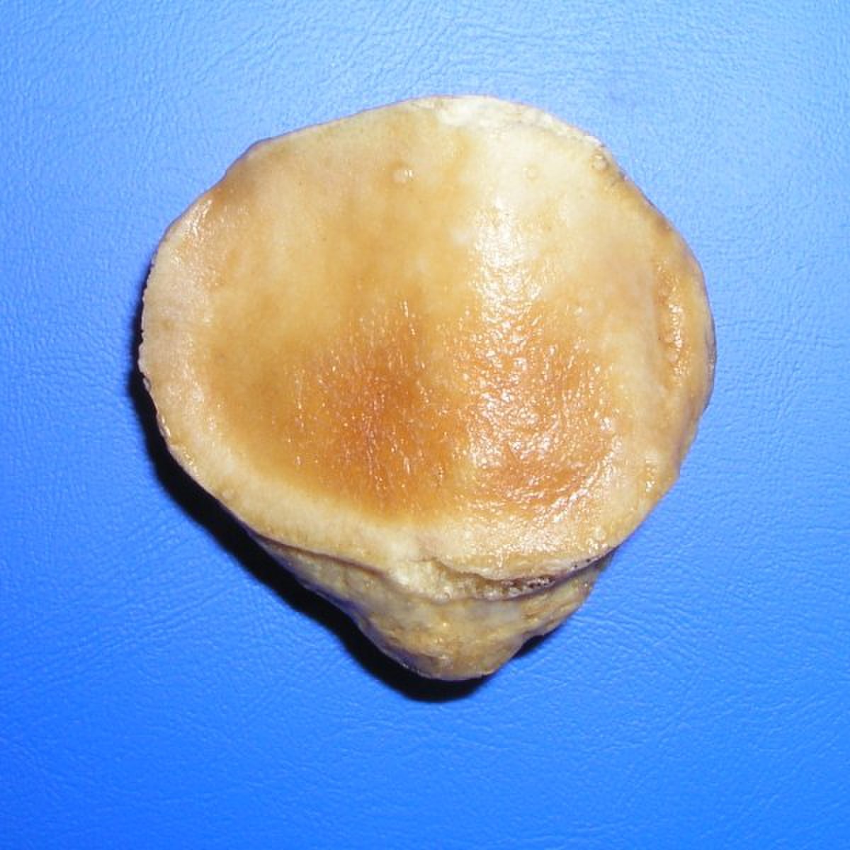 Patella (os)