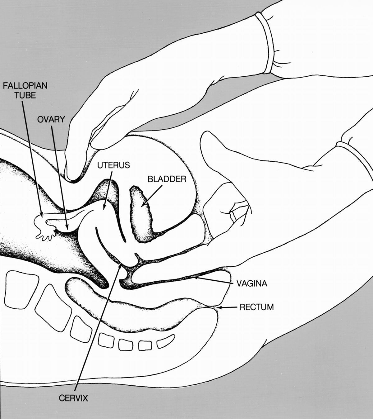 Toucher vaginal