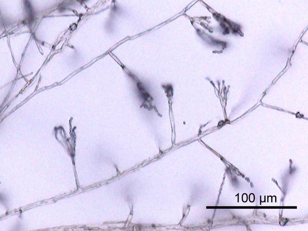 Ascomycota (classification phylogénétique)