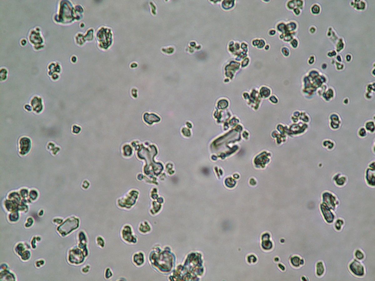 Phytolithe