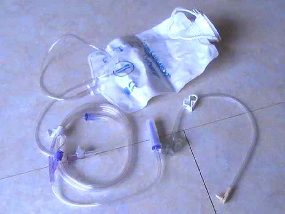 Gastrostomie endoscopique percutanée
