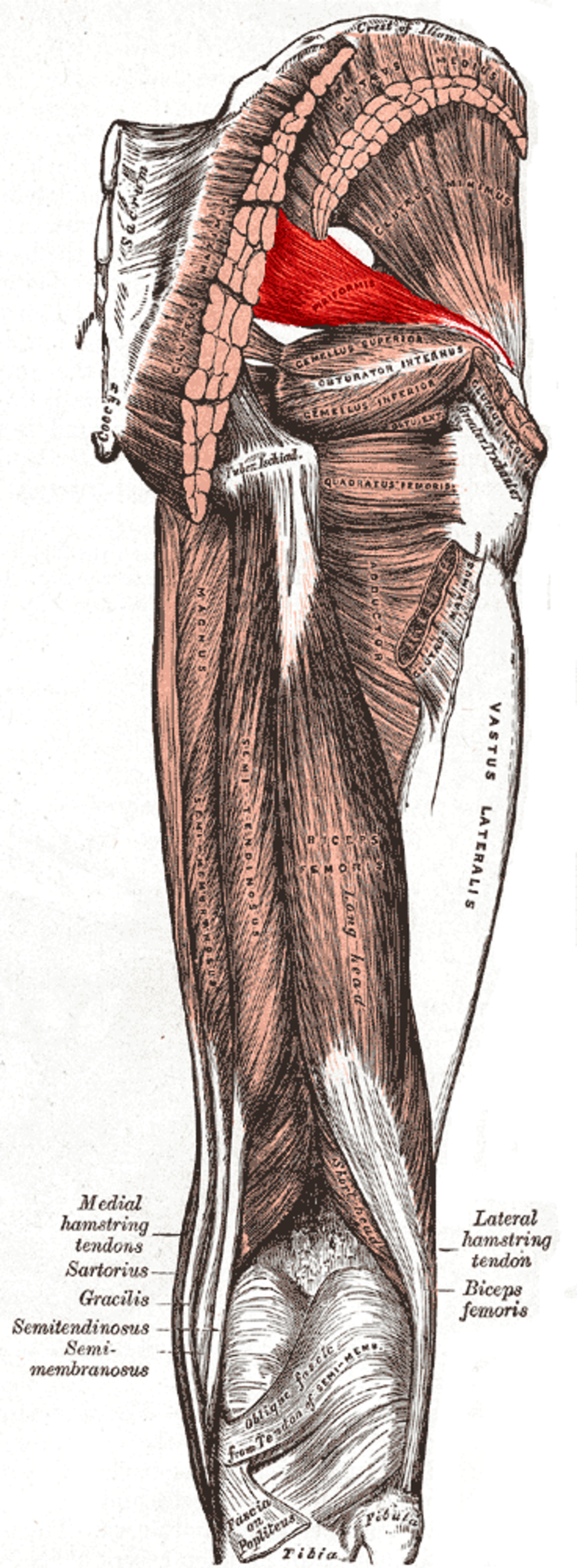 Muscle piriforme