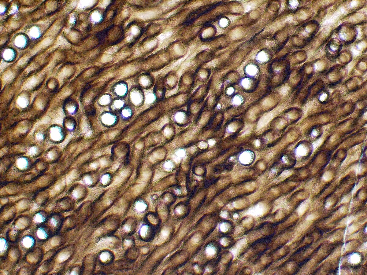 Prototaxites