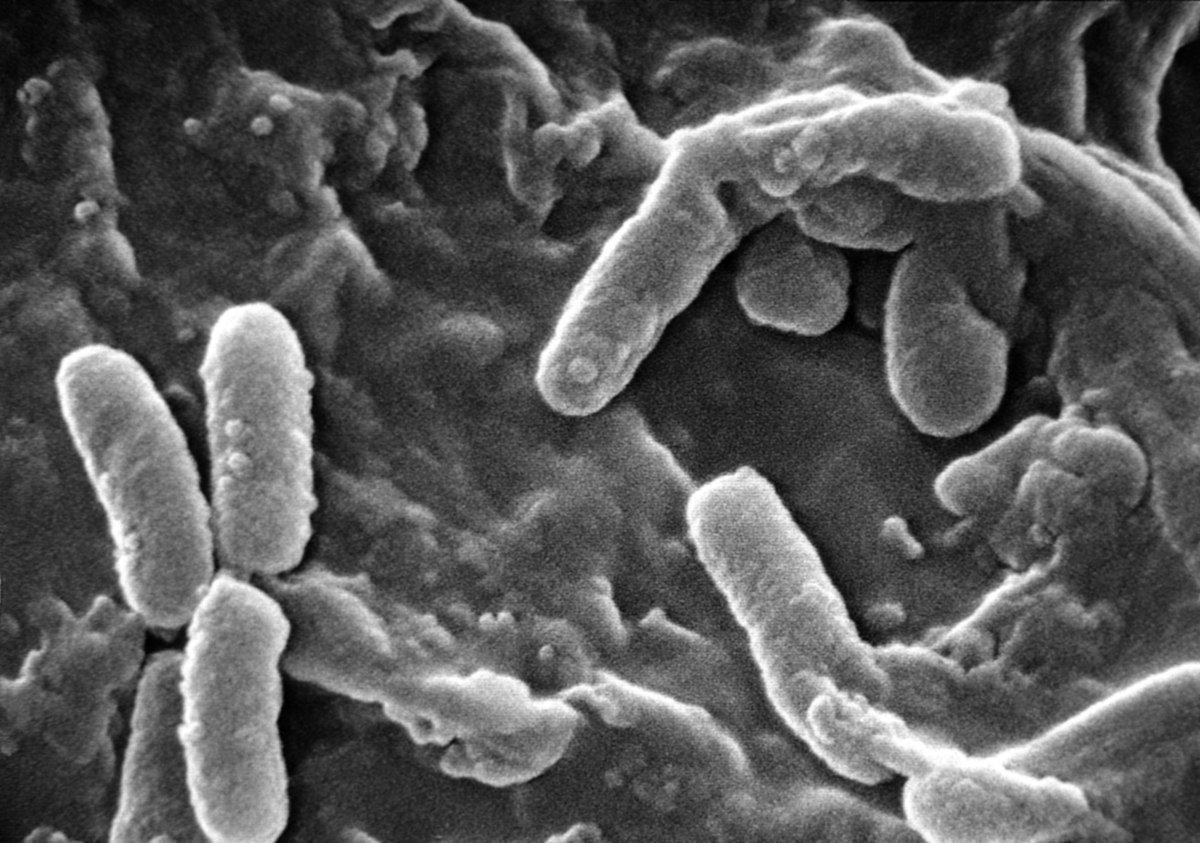 Pseudomonas aeruginosa au microscope électronique à balayage
