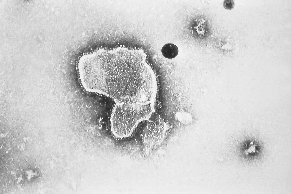 Virus respiratoire syncytial