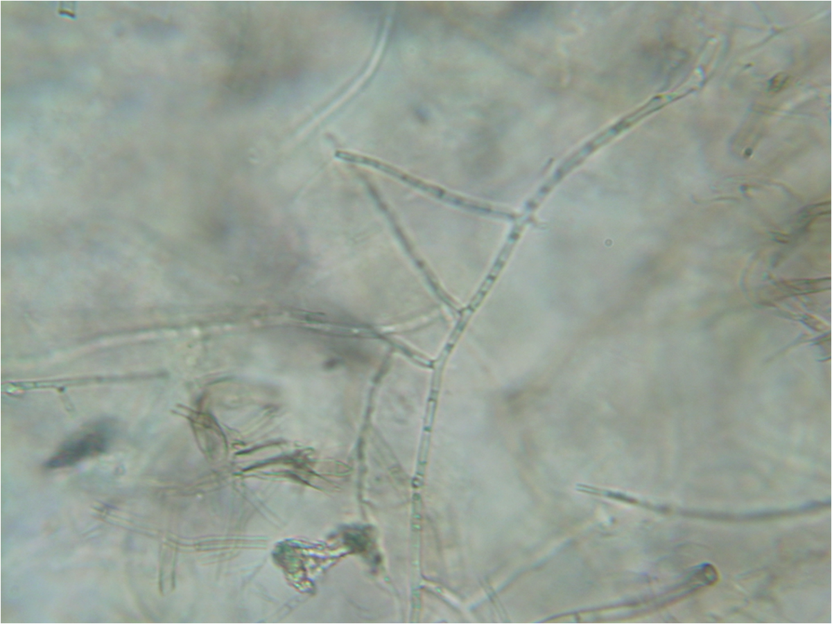 Rhizoctone brun