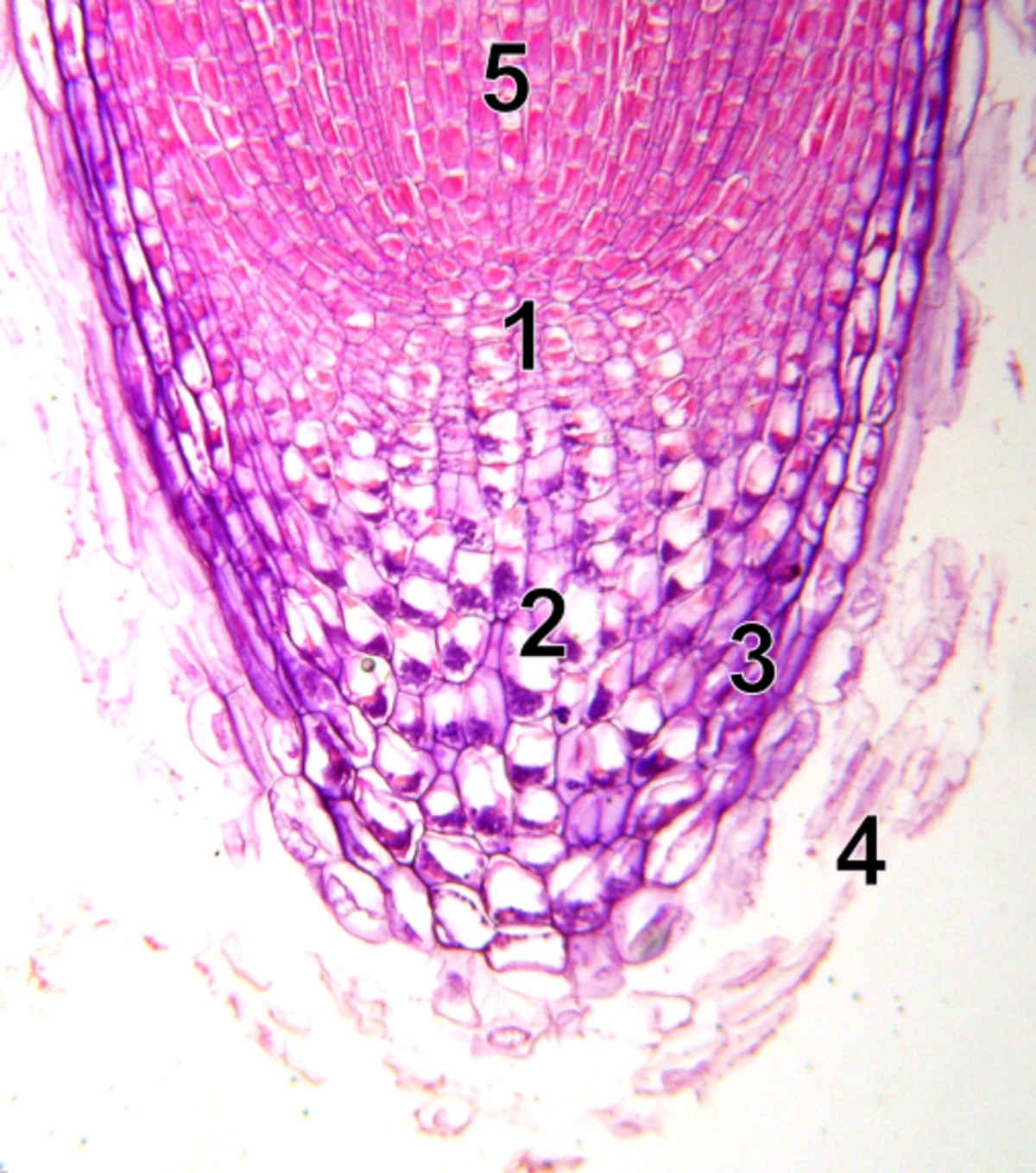 Statocyte