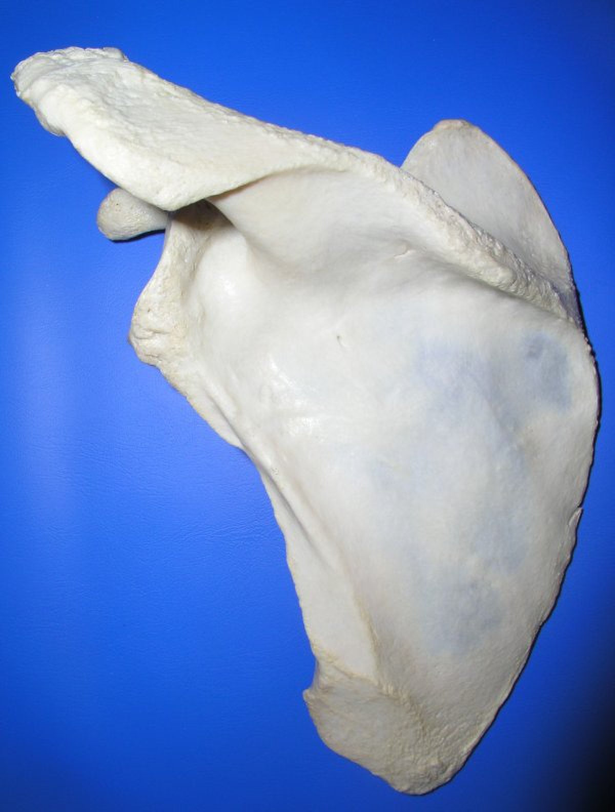 Scapula post.jpg