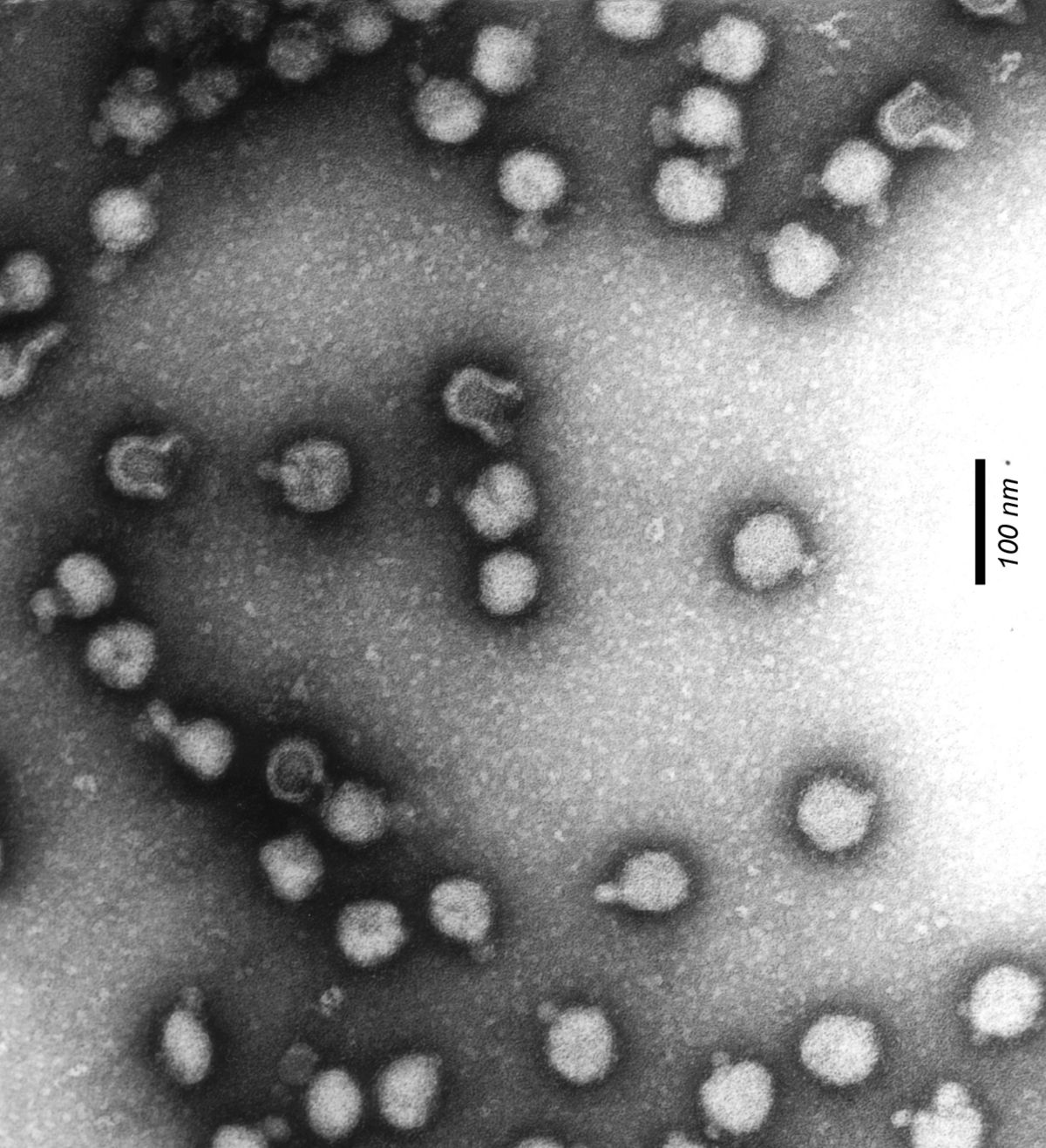 Virus de la forêt de Semliki