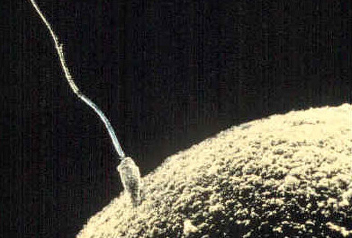 Ovule