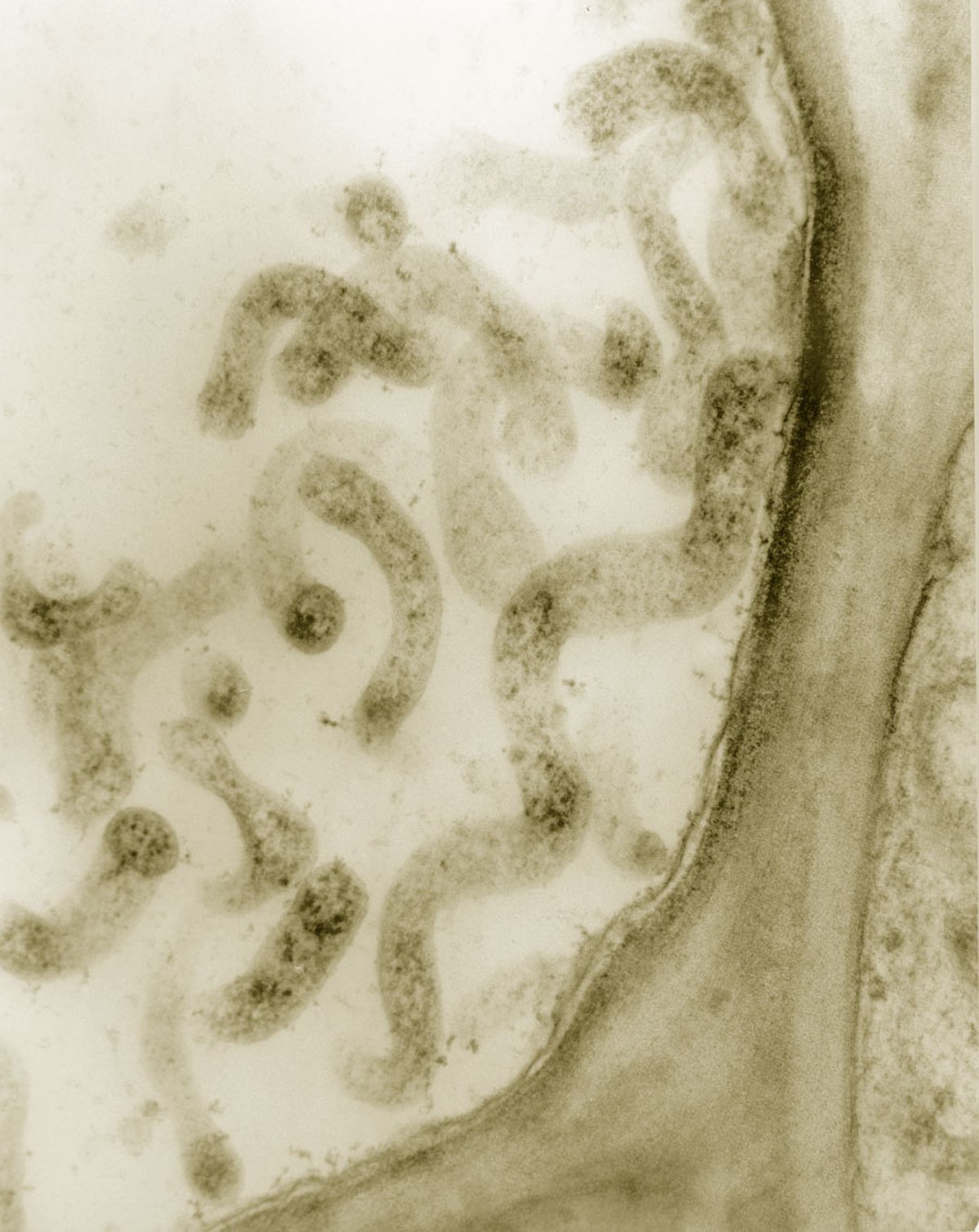 Mycoplasma