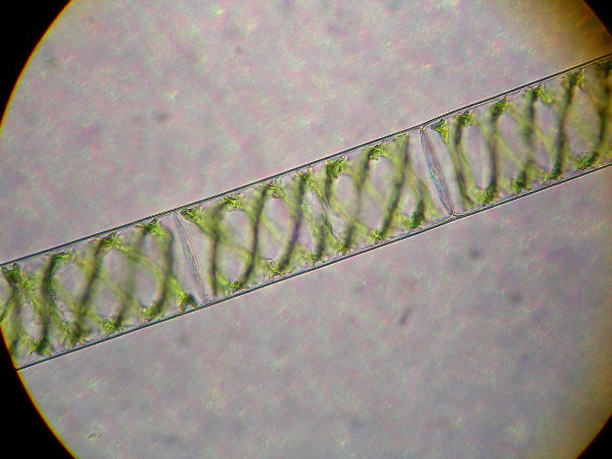 Spirogyre